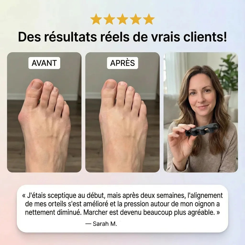 OrthoStep™ — Séparateur d’orteils en silicone de grade médical