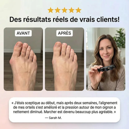 OrthoStep™ — Séparateur d’orteils en silicone de grade médical